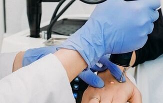 formas de eliminar as verrugas